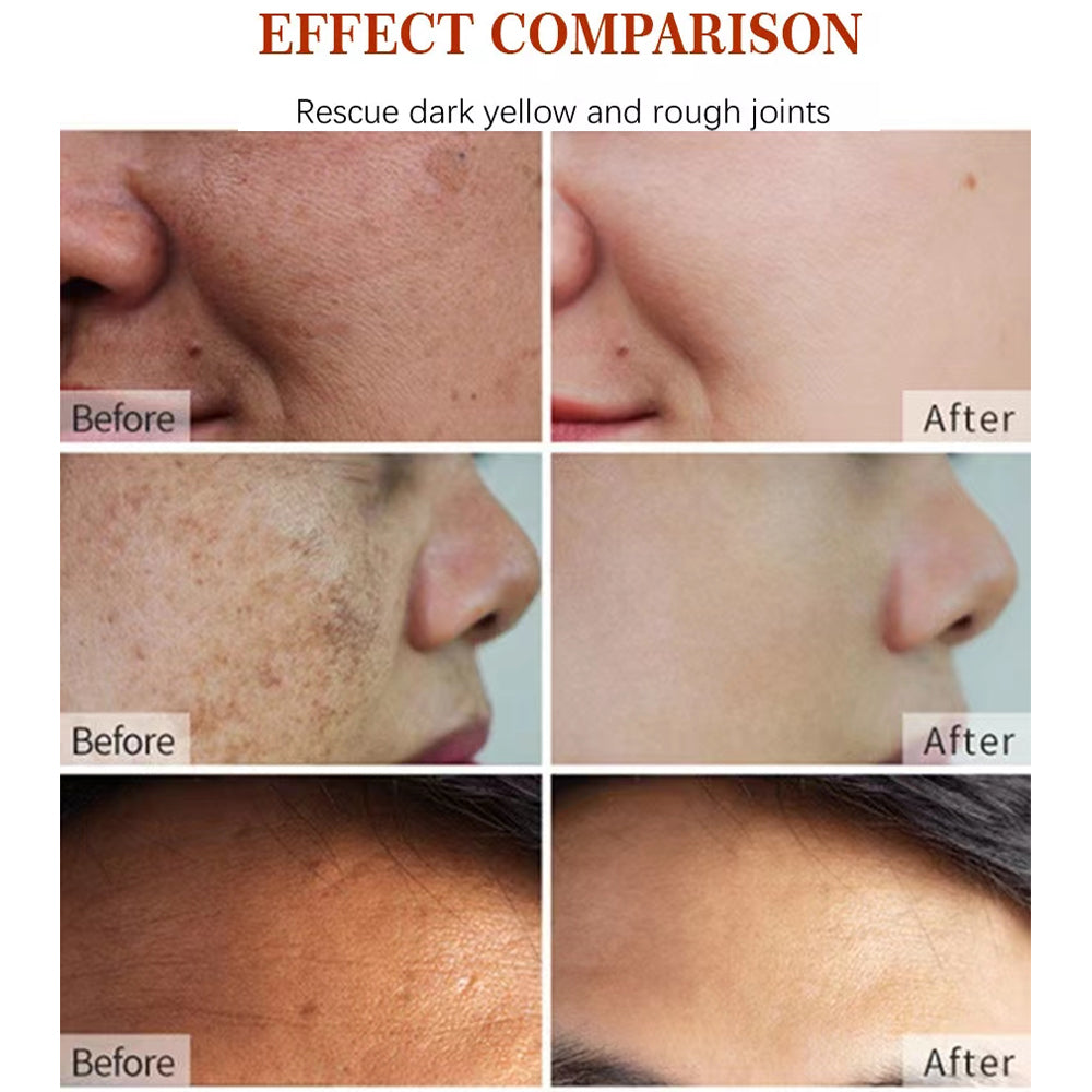 Beauty Cream. Korean Natural Vegan Neck Facial Vitamin C Acne Pimples Dark Spot Remover