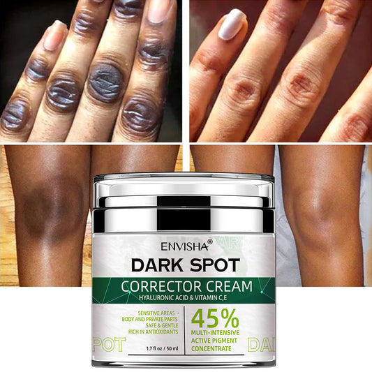 Beauty Cream. Korean Natural Vegan Neck Facial Vitamin C Acne Pimples Dark Spot Remover